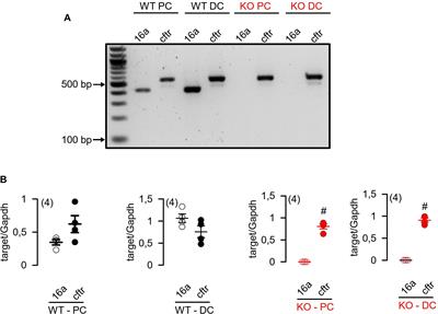 Control of Ion Transport by Tmem16a Expressed in Murine Intestine